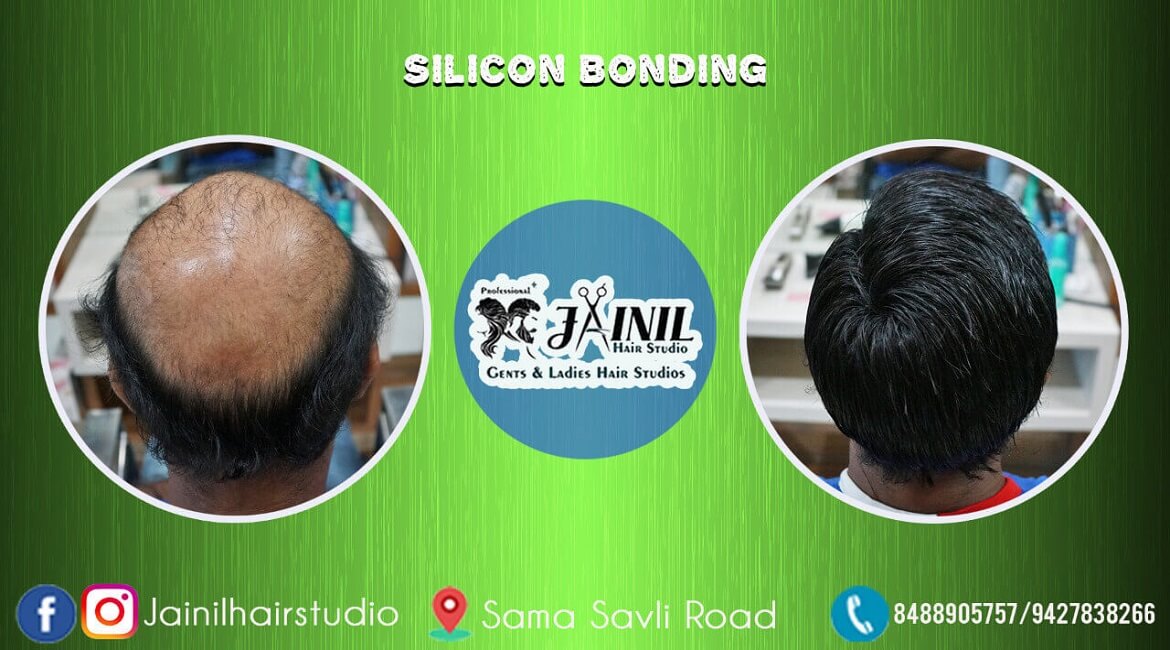 Best Hair Silicon Treatment in Vadodara  Silicon Bonding