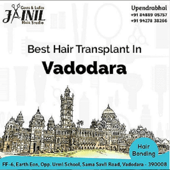 Best Hair transplant in Vadodara