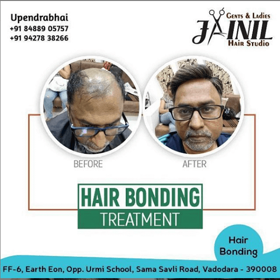 Hair Bonding Treatment in Vadodara