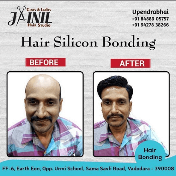 Hair Bonding Treatment in Vadodara