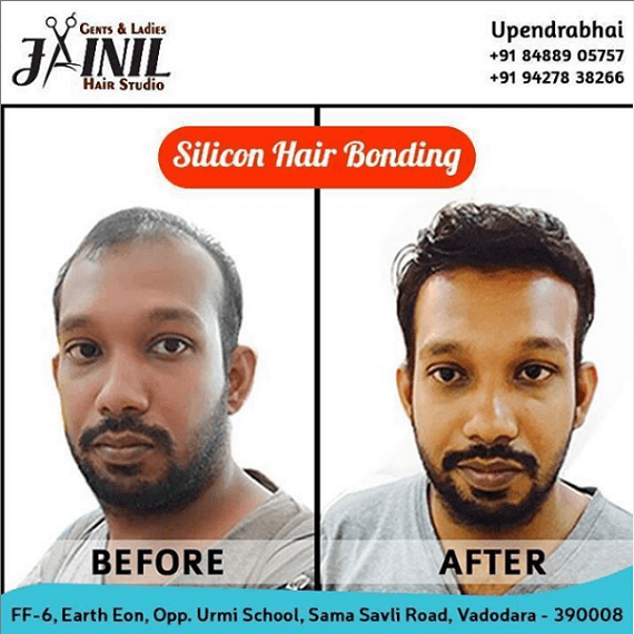 Best Silicon Hair Bonding in Vadodara Gujarat India